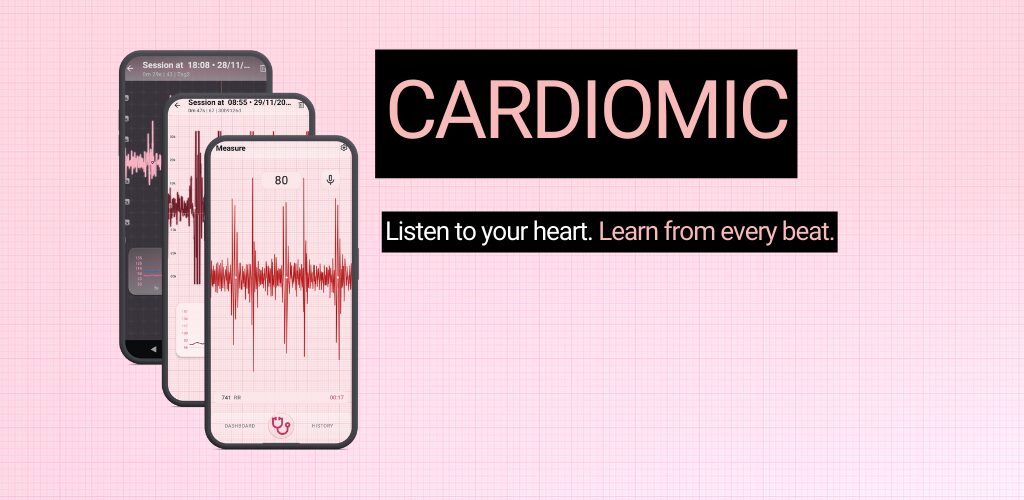 Cardiomic